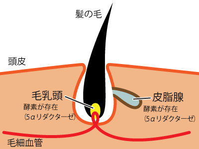 AGA(男性型脱毛症)の原因とメカニズム1