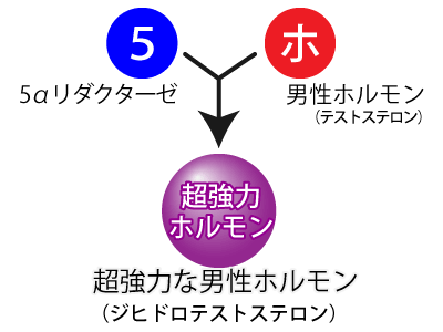 AGA(男性型脱毛症)の原因とメカニズム2