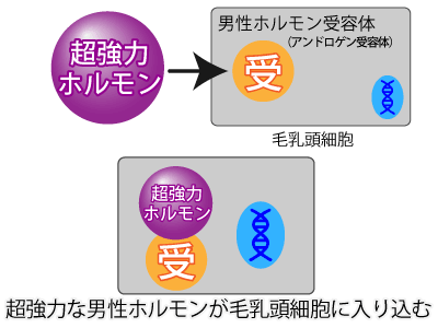 AGA(男性型脱毛症)の原因とメカニズム3