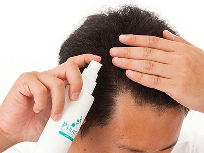 M字ハゲにおすすめの育毛剤6