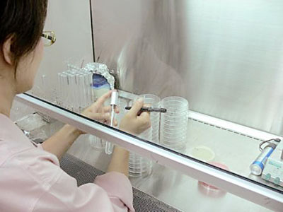 M字ハゲにおすすめの育毛剤4